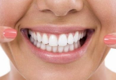 Come migliorare esteticamente il proprio sorriso